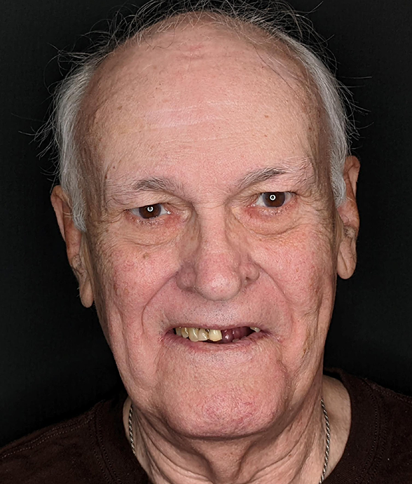 Dennis O. before