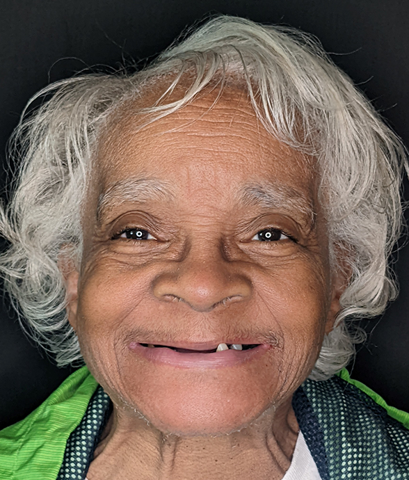 Diane R. before