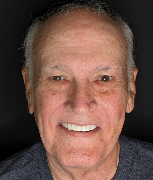 Dennis O. after