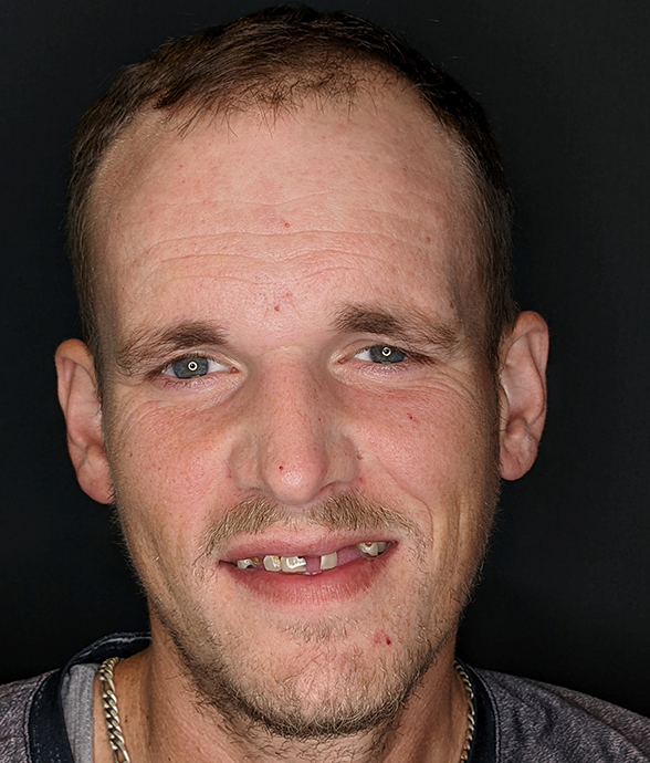 Jeremy B. before