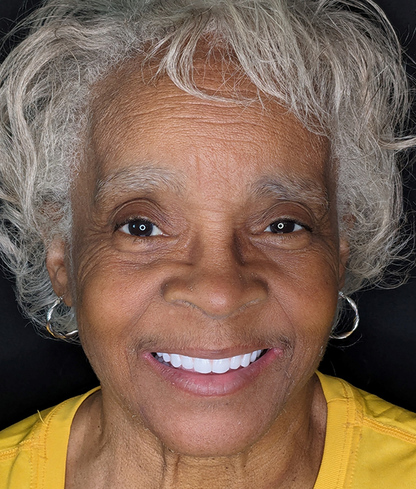 Diane R. after